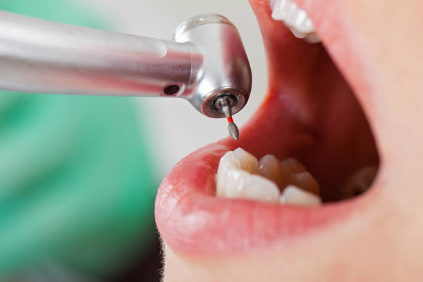 Best Lost Filling or Crown Replacement in Henrietta, TX